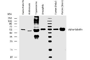 Western blotting analysis of human alpha-tubulin using rat monoclonal antibody YOL1/34 on lysates of Caenorhabditis elegans, Arabidopsis thaliana, Trypanosoma brucei, Drosophila melanogaster, human HeLa cell line, and porcine brain, all under reducing conditions.
