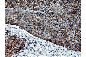 Image no. 2 for anti-Deoxythymidylate Kinase (Thymidylate Kinase) (DTYMK) antibody (ABIN1497918) (DTYMK anticorps)