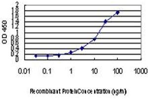 Detection limit for recombinant GST tagged ENC1 is approximately 0.