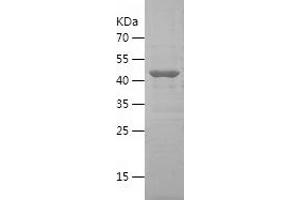 Western Blotting (WB) image for CTP Synthase (CTPS) (AA 375-591) protein (His-IF2DI Tag) (ABIN7122511)