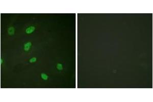 Immunofluorescence analysis of HeLa cells, using Histone H2B (Acetyl-Lys5) Antibody. (Histone H2B anticorps  (acLys5))