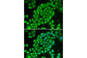Immunofluorescence analysis of U2OS cell using TCL1A antibody. (TCL1A anticorps)