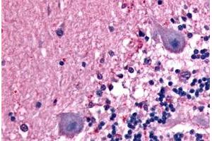 Immunohistochemical staining of formalin-fixed, paraffin-embedded human brain, neurons tissue after heat-induced antigen retrieval. (BAI1 anticorps  (C-Term))