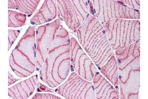 Human Skeletal Muscle: Formalin-Fixed, Paraffin-Embedded (FFPE) (ACTN2 anticorps)