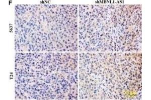 Inhibition of MBNL1-AS1 promoted the tumorigenesis of BC cells through the regulation of miR-135a/PHLPP2/FOXO1 in vivo.