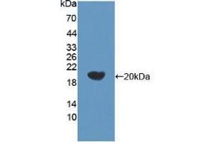 Western blot analysis of recombinant Human bACE2. (BACE2 anticorps  (AA 230-396))