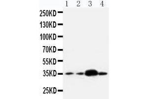 Anti-APE1 antibody, Western blotting Lane 1: U87 Cell Lysate Lane 2: A549 Cell Lysate Lane 3: SMMC Cell Lysate Lane 4: HELA Cell Lysate (APEX1 anticorps  (Middle Region))