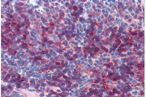 Mouse Spleen (formalin-fixed, paraffin-embedded) stained with BSG antibody ABIN462349 followed by biotinylated secondary antibody, alkaline phosphatase-streptavidin and chromogen. (CD147 anticorps)