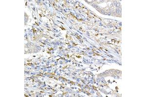 Immunohistochemistry of paraffin-embedded human placenta using TOM20 Rabbit mAb (ABIN7268554) at dilution of 1:100 (40x lens).