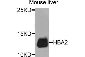 Western blot analysis of extracts of mouse liver, using HBA2 antibody. (HBa2 anticorps)