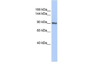 WB Suggested Anti-TNNI3K Antibody Titration:  0. (TNNI3K anticorps  (Middle Region))