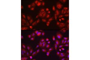 anti-Galactosylceramidase (GALC) (AA 40-300) antibody