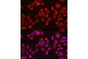 Immunohistochemistry of paraffin-embedded mouse testis using GALC antibody (ABIN1679950, ABIN3018222, ABIN3018224 and ABIN6220405) at dilution of 1:100 (40x lens). (GALC anticorps  (AA 40-300))