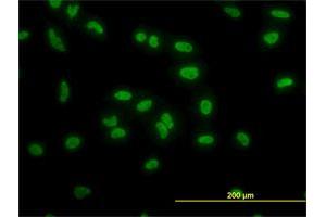 Immunofluorescence of monoclonal antibody to TAF11 on HeLa cell. (TAF11 anticorps  (AA 158-210))