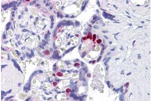 Human Placenta: Formalin-Fixed, Paraffin-Embedded (FFPE)