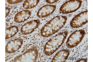 Immunoperoxidase of monoclonal antibody to EPB41 on formalin-fixed paraffin-embedded human colon.