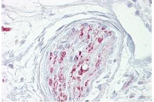 Nerve stained with CA2D1 Antibody in Immunohistochemistry on Paraffin Sections (CACNA2D1 anticorps)
