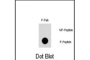 Dot blot analysis of Phospho-TSC2- polyclonal antibody (ABIN1881949 and ABIN2839674) on nitrocellulose membrane. (Tuberin anticorps  (pSer1387))