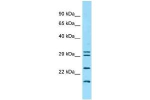 Western Blotting (WB) image for anti-Interferon, kappa (IFNK) (C-Term) antibody (ABIN2789152) (IFNK anticorps  (C-Term))