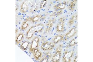 Immunohistochemistry of paraffin-embedded rat kidney using AMBRA1 antibody (ABIN5970441) at dilution of 1/100 (40x lens). (AMBRA1 anticorps)