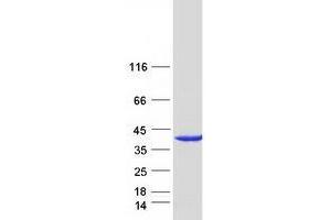 Validation with Western Blot