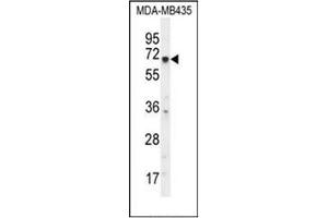 Western blot analysis of KCNQ1 Antibody (N-term) in MDA-MB435 cell line lysates (35ug/lane). (KCNQ1 anticorps  (N-Term))