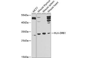 Western blot analysis of extracts of various cell lines, using HLA-DRB1 antibody (ABIN6131759, ABIN6141831, ABIN6141832 and ABIN6223610) at 1:1000 dilution. (HLA-DRB1 anticorps  (AA 30-230))
