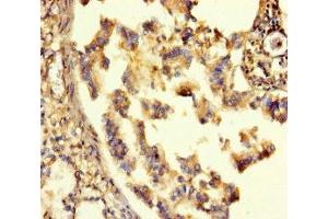 Immunohistochemistry of paraffin-embedded human lung tissue using ABIN7153489 at dilution of 1:100