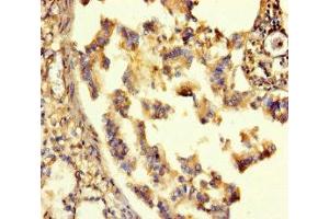 Immunohistochemistry of paraffin-embedded human lung tissue using ABIN7153489 at dilution of 1:100 (GABRA6 anticorps  (AA 20-242))