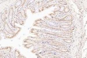Immunohistochemistry analysis of paraffin-embedded rat colon using,TORC1 (ABIN7073590) at dilution of 1: 800 (CRTC1 anticorps)