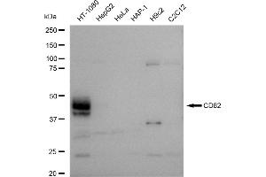 Western blotting analysis using CD82 antibody (ABIN7797982). (Recombinant CD82 anticorps)