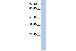 WB Suggested Anti-OSBPL8 Antibody Titration:  0. (OSBPL8 anticorps  (N-Term))