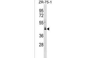 PCMTD2 Antibody (C-term) (ABIN1536944 and ABIN2849981) western blot analysis in ZR-75-1 cell line lysates (35 μg/lane). (PCMTD2 anticorps  (C-Term))