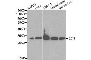 Western blot analysis of extracts of various cell lines, using ECI1 antibody. (DCI anticorps)