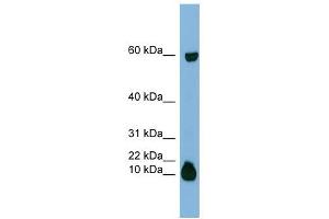 STATH antibody used at 1 ug/ml to detect target protein.