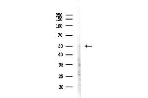 anti-Ubiquitin Family Domain Containing 1 (UBFD1) (Internal Region) antibody