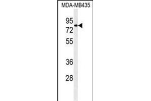 Western blot analysis of ATHL1 Antibody (C-term) (ABIN1881084 and ABIN2840111) in MDA-M cell line lysates (35 μg/lane). (ATHL1 anticorps  (C-Term))