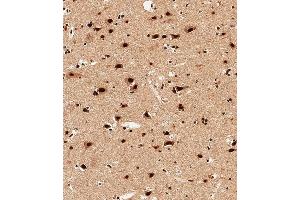 Immunohistochemical analysis of paraffin-embedded Human brain tissue using A performed on the Leica® BOND RXm. (SNRPD3 anticorps  (N-Term))