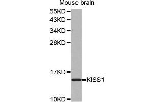 Western blot analysis of extracts of mouse brain, using KISS1 antibody (ABIN5971535). (KISS1 anticorps)