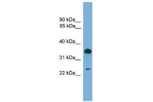 TPD52 antibody used at 0. (TPD52 anticorps  (C-Term))