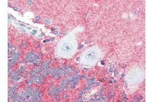 Human Brain, Cerebellum (formalin-fixed, paraffin-embedded) stained with SLITRK2at 5 µg/ml followed by biotinylated goat anti-rabbit IgG secondary antibody, alkaline phosphatase-streptavidin and chromogen. (SLITRK2 anticorps  (C-Term))
