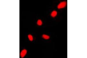 Immunofluorescent analysis of CHK2 staining in HL60 cells.
