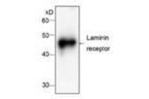 Image no. 1 for anti-Ribosomal Protein SA (RPSA) antibody (ABIN791537) (RPSA/Laminin Receptor anticorps)