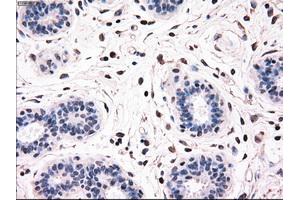 Immunohistochemical staining of paraffin-embedded breast tissue using anti-BRAF mouse monoclonal antibody. (BRAF anticorps)