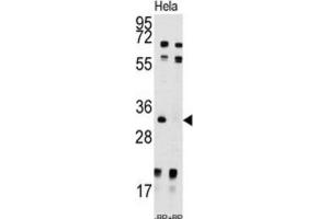 Western Blotting (WB) image for anti-Uridine-Cytidine Kinase 2 (UCK2) antibody (ABIN3003032) (UCK2 anticorps)