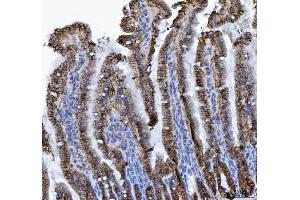 IHC analysis of LI Cadherin/CDH17 using anti-LI Cadherin/CDH17 antibody (ABIN7600855). (LI Cadherin anticorps  (AA 24-695))