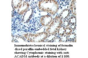 Image no. 1 for anti-Medium-Chain Specific Acyl-CoA Dehydrogenase, Mitochondrial (MCAD) antibody (ABIN791208) (Medium-Chain Specific Acyl-CoA Dehydrogenase, Mitochondrial (MCAD) anticorps)