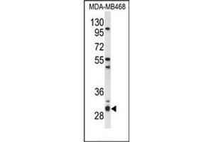 Western blot analysis of PSMG2 Antibody (C-term) in MDA-MB468 cell line lysates (35ug/lane). (PSMG2 anticorps  (C-Term))