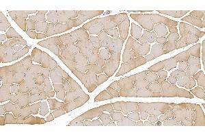 Detection of ACTC1 in Human Skeletal muscle Tissue using Monoclonal Antibody to Actin Alpha 1, Cardiac Muscle (ACTC1)