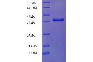 SDS-PAGE (SDS) image for Nuclear Import 7 Homolog (NIP7) (AA 1-180), (full length) protein (His-SUMO Tag) (ABIN5712007)